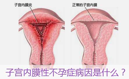 子宫内膜回声不均匀怎么办?